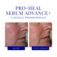 Pro-Heal Serum Advance+ 15 ml